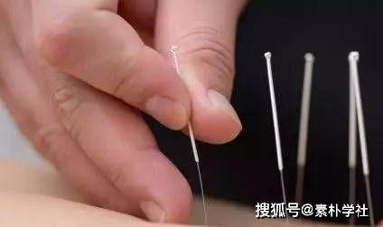 成人臀部灌肠针灸视频讲解,视频详解与实操指导